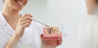 Implanty zębowe: rewolucja w odbudowie utraconego uzębienia