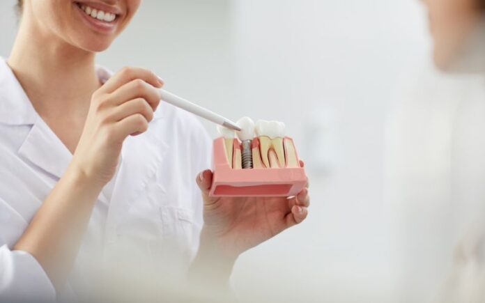 Implanty zębowe: rewolucja w odbudowie utraconego uzębienia