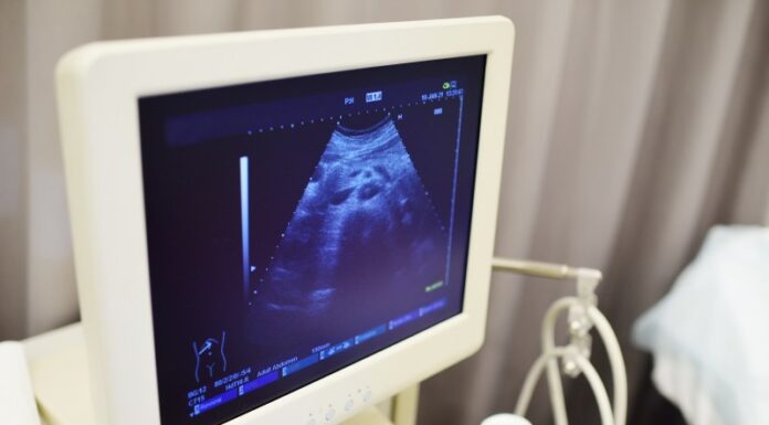 Historia pewnego badania USG Opowieść o badaniu ultrasonograficznym