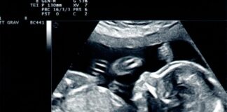 Wszystko, co powinnaś wiedzieć o badaniu USG w ciąży