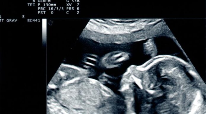 Co warto wiedzieć o USG w ciąży Wszystko, co powinnaś wiedzieć o badaniu USG w ciąży